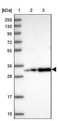 Western Blot: CCDC127 Antibody [NBP1-91756] - Lane 1: Marker  [kDa] 250, 130, 95, 72, 55, 36, 28, 17, 10.  Lane 2: Human cell line RT-4.  Lane 3: Human cell line U-251MG sp