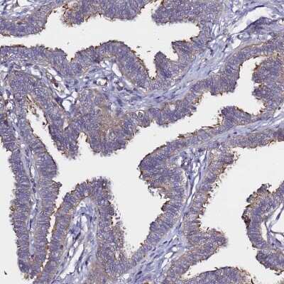 Immunohistochemistry-Paraffin: CCDC13 Antibody [NBP2-14445] - Staining of human fallopian tube shows strong positivity in cilia.