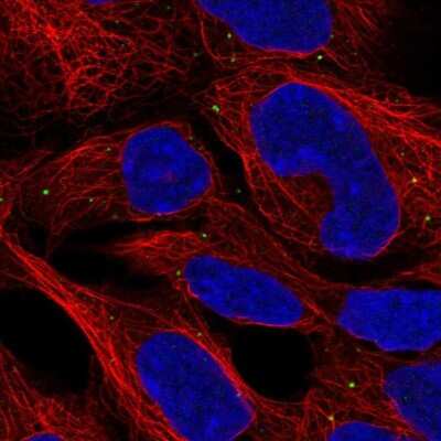 Immunocytochemistry/Immunofluorescence: CCDC130 Antibody [NBP2-30959] - Staining of human cell line HEK 293 shows localization to vesicles. Antibody staining is shown in green.