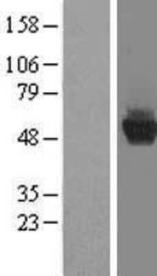 Western Blot CCDC130 Overexpression Lysate