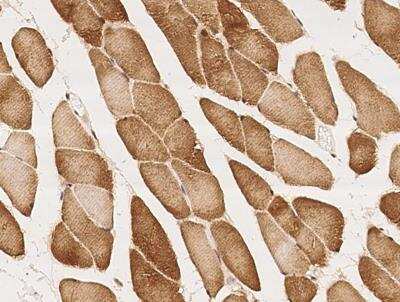Immunohistochemistry-Paraffin: CCDC137 Antibody [NBP3-12572] - Staining of human CCDC137 in human skeletal muscle with rabbit polyclonal antibody at 1:100 dilution.