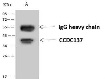 Immunoprecipitation: CCDC137 Antibody [NBP3-12572] - Lane A:0.5 mg HCT116 Whole Cell Lysate4 uL anti-CCDC137 rabbit polyclonal antibody and 60 ug of Immunomagnetic beads Protein A/G.Primary antibody:Anti-CCDC137 rabbit polyclonal antibody,at 1:100 dilution Secondary antibody:Goat Anti-Rabbit IgG (H+L)/HRP at 1/10000 dilutionDeveloped using the ECL technique.Performed under reducing conditions.Predicted band size: 33 kDaObserved band size :38 kDa