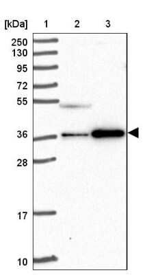 Western Blot: CCDC137 Antibody [NBP2-31033] - Lane 1: Marker  [kDa] 250, 130, 95, 72, 55, 36, 28, 17, 10.  Lane 2: Human cell line RT-4.  Lane 3: Human cell line U-251MG sp