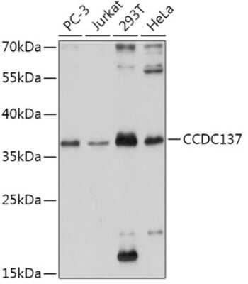 Western Blot: CCDC137 Antibody [NBP2-92389] - Analysis of extracts of various cell lines, using CCDC137 at 1:1000 dilution.Secondary antibody: HRP Goat Anti-Rabbit IgG (H+L) at 1:10000 dilution.Lysates/proteins: 25ug per lane.Blocking buffer: 3% nonfat dry milk in TBST.Detection: ECL Basic Kit .Exposure time: 20s.
