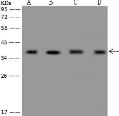 Western Blot: CCDC137 Antibody [NBP3-12572] - Lane A: A549 Whole Cell LysateLane B: H1299 Whole Cell LysateLane C: HCT116 Whole Cell LysateLane D: Jurkat Whole Cell LysateLysates/proteins at 30 ug per lane.SecondaryGoat Anti-Rabbit IgG (H+L)/HRP at 1/10000 dilution.Developed using the ECL technique.Performed under reducing conditions.Predicted band size:33 kDaObserved band size:38 kDa