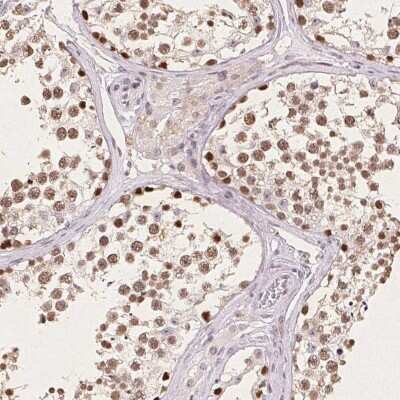 Immunohistochemistry: CCDC138 Antibody [NBP2-49123] - Staining of human testis shows moderate nuclear positivity in cells in seminiferous ducts.