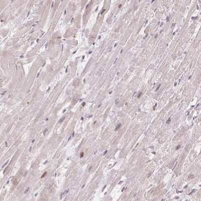 Immunohistochemistry-Paraffin: CCDC138 Antibody [NBP2-49123] - Staining of human heart muscle shows low expression as expected.