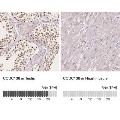 <b>Orthogonal Strategies Validation. </b>Immunohistochemistry-Paraffin: CCDC138 Antibody [NBP2-49123] - Staining in human testis and heart muscle tissues using anti-CCDC138 antibody. Corresponding CCDC138 RNA-seq data are presented for the same tissues.