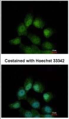 Immunocytochemistry/Immunofluorescence: CCDC14 Antibody [NBP2-15742] - Immunofluorescence analysis of paraformaldehyde-fixed A431, using antibody at 1:500 dilution.