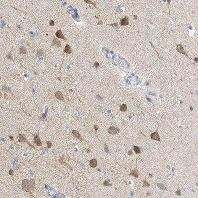 Immunohistochemistry: CCDC14 Antibody [NBP1-84183] - Staining of human cerebral cortex shows moderate cytoplasmic positivity in neuronal cells.