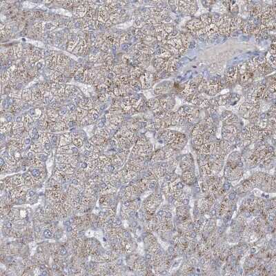 Immunohistochemistry-Paraffin: CCDC14 Antibody [NBP2-33998] - Staining of human liver shows moderate cytoplasmic positivity in hepatocytes.