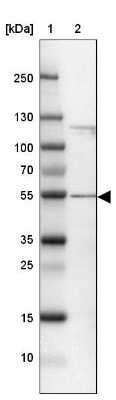 Western Blot: CCDC14 Antibody [NBP2-33998] - Lane 1: Marker  [kDa] 250, 130, 100, 70, 55, 35, 25, 15, 10.  Lane 2: U-2 OS