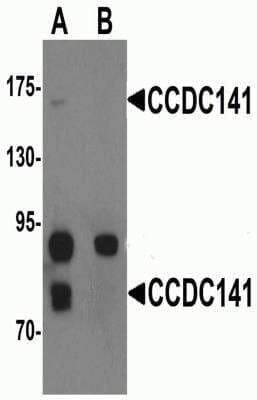 Western Blot CCDC141 Antibody - BSA Free