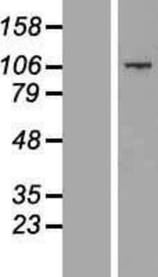 Western Blot: CCDC141 Overexpression Lysate (Adult Normal) [NBP2-05127] Left-Empty vector transfected control cell lysate (HEK293 cell lysate); Right -Over-expression Lysate for CCDC141.