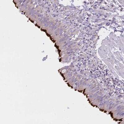 Immunohistochemistry-Paraffin CCDC142 Antibody - BSA Free