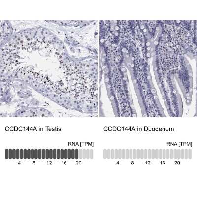 Immunocytochemistry/Immunofluorescence: CCDC144A Antibody [NBP3-17075] - Analysis in human testis and duodenum tissues using Anti-CCDC144A antibody. Corresponding CCDC144A RNA-seq data are presented for the same tissues.