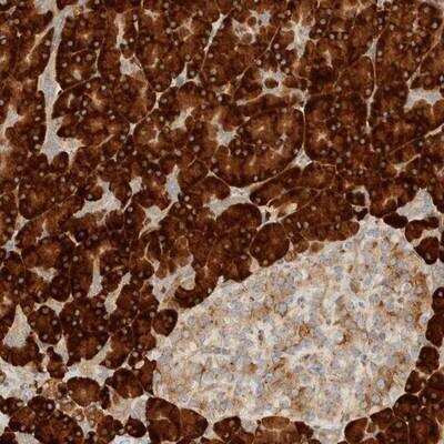 Immunohistochemistry: CCDC144A Antibody [NBP1-93756] - Staining of human pancreas shows strong cytoplasmic positivity in exocrine cells.