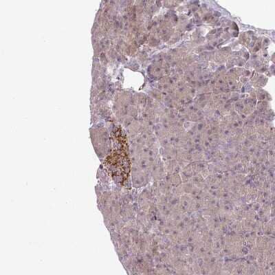 Immunohistochemistry: CCDC144A Antibody [NBP2-48881] - Staining of human pancreas shows strong cytoplasmic positivity in islets of Langerhans.