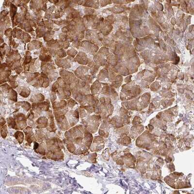 Immunohistochemistry-Paraffin: CCDC144A Antibody [NBP1-93756] - Staining of human pancreas shows strong cytoplasmic positivity in exocrine glandular cells.