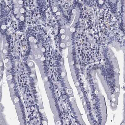 Immunohistochemistry-Paraffin: CCDC144A Antibody [NBP3-17075] - Staining of human duodenum shows low expression as expected.