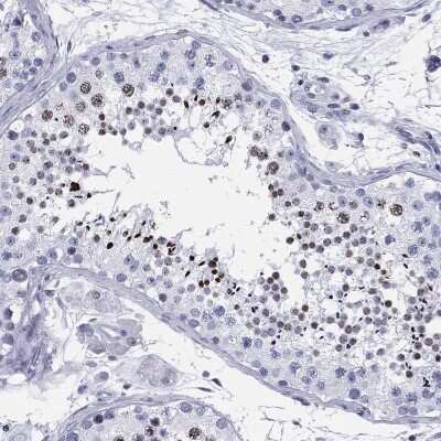 Immunohistochemistry-Paraffin: CCDC144A Antibody [NBP3-17075] - Staining of human testis shows high expression.