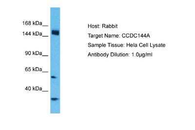 Western Blot: CCDC144A Antibody [NBP2-87142] - Host: Rabbit. Target Name: CCDC144A. Sample Type: Hela Whole cell lysates. Antibody Dilution: 1.0ug/ml