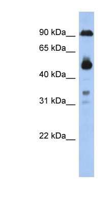 Western Blot: CCDC144B Antibody [NBP1-91467] - 293T cells lysate, concentration 0.2-1 ug/ml.