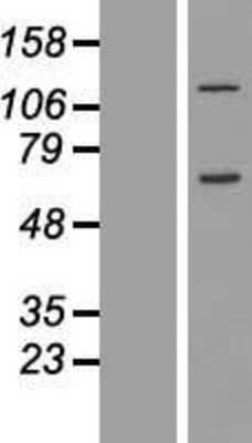 Western Blot: CCDC146 Overexpression Lysate (Adult Normal) [NBL1-08782] Left-Empty vector transfected control cell lysate (HEK293 cell lysate); Right -Over-expression Lysate for CCDC146.