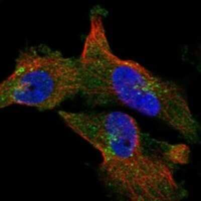 Immunocytochemistry/Immunofluorescence: CCDC147 Antibody [NBP3-17284] - Staining of human cell line U-251 MG shows localization to plasma membrane & vesicles.