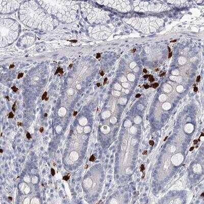 Immunohistochemistry: CCDC147 Antibody [NBP1-90782] - Staining of human duodenum shows strong cytoplasmic positivity in inflammatory cells.