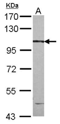 Western Blot: CCDC147 Antibody [NBP2-15743] - Sample (30 ug of whole cell lysate) A: NT2D1 7. 5% SDS PAGE gel, diluted at 1:1000.