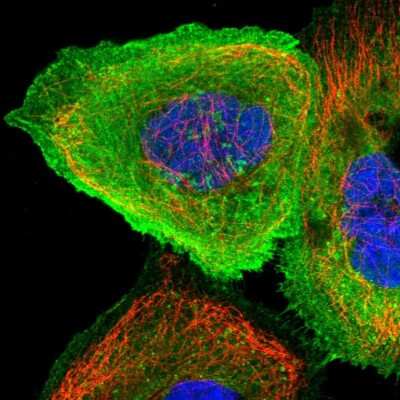 Immunocytochemistry/Immunofluorescence: CCDC15 Antibody [NBP1-82263] - Immunofluorescent staining of human cell line A-431 shows localization to plasma membrane & cytosol.