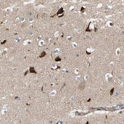 Immunohistochemistry-Paraffin: CCDC155 Antibody [NBP1-81992] - Staining of human cerebral cortex shows distinct cytoplasmic positivity in neurons.