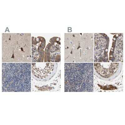 <b>Independent Antibodies Validation. </b>Immunohistochemistry-Paraffin: CCDC155 Antibody [NBP1-81992] - Staining of human cerebral cortex, colon, lymph node and testis using Anti-CCDC155 antibody NBP1-81992 (A) shows similar protein distribution across tissues to independent antibody NBP1-81993 (B).