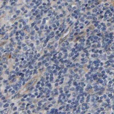 Immunohistochemistry-Paraffin: CCDC155 Antibody [NBP1-81992] - Staining of human lymph node.