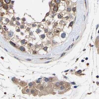 Immunohistochemistry-Paraffin: CCDC155 Antibody [NBP1-81992] - Staining of human testis.
