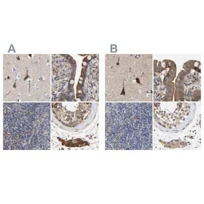 Immunohistochemistry-Paraffin: CCDC155 Antibody [NBP1-81993] - Staining of human cerebral cortex, colon, lymph node and testis using Anti-CCDC155 antibody NBP1-81993 (A) shows similar protein distribution across tissues to independent antibody NBP1-81992 (B).