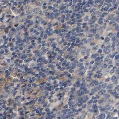 Immunohistochemistry-Paraffin: CCDC155 Antibody [NBP1-81993] - Staining of human lymph node.