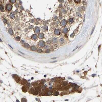 Immunohistochemistry-Paraffin: CCDC155 Antibody [NBP1-81993] - Staining of human testis.