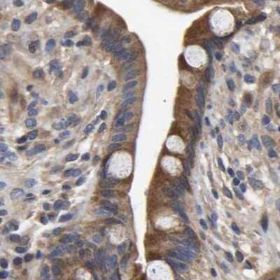 Immunohistochemistry-Paraffin: CCDC155 Antibody [NBP1-81993] - Staining of human colon.