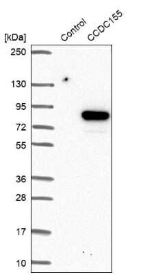Western Blot: CCDC155 Antibody [NBP1-81993] - Analysis in control (vector only transfected HEK293T lysate) and CCDC155 over-expression lysate (Co-expressed with a C-terminal myc-DDK tag (3.1 kDa) in mammalian HEK293T cells).