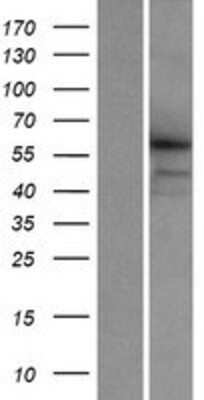 Western Blot: CCDC155 Overexpression Lysate (Adult Normal) [NBP2-05535] Left-Empty vector transfected control cell lysate (HEK293 cell lysate); Right -Over-expression Lysate for CCDC155.