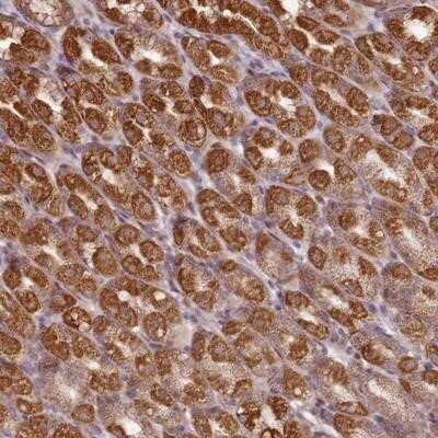 Immunohistochemistry-Paraffin: CCDC159 Antibody [NBP1-94186] - Staining of human stomach, lower shows strong cytoplasmic positivity in glandular cells.