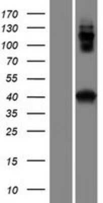 Western Blot: CCDC159 Overexpression Lysate (Adult Normal) [NBP2-08400] Left-Empty vector transfected control cell lysate (HEK293 cell lysate); Right -Over-expression Lysate for CCDC159.