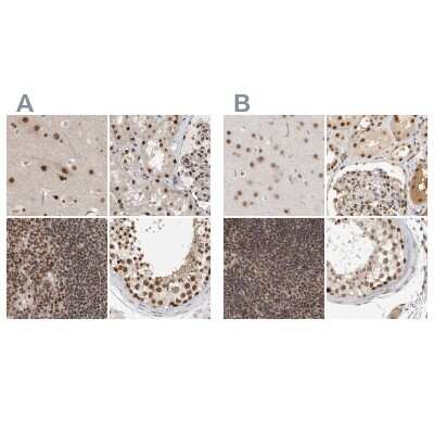 Immunohistochemistry-Paraffin: CCDC16 Antibody [NBP1-88164] - Staining of human cerebral cortex, kidney, lymph node and testis using Anti-ZNF830 antibody NBP1-88164 (A) shows similar protein distribution across tissues to independent antibody NBP1-88165 (B).