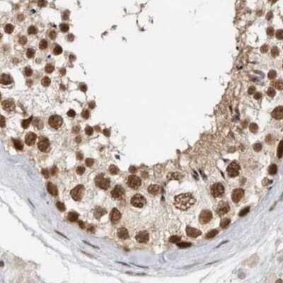 Immunohistochemistry-Paraffin: CCDC16 Antibody [NBP1-88164] - Staining of human testis.