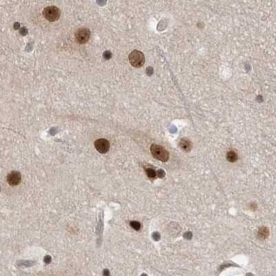 Immunohistochemistry-Paraffin: CCDC16 Antibody [NBP1-88164] - Staining of human cerebral cortex.