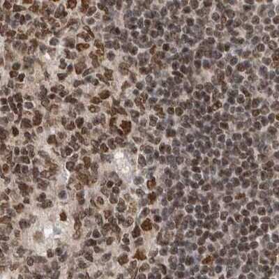 Immunohistochemistry-Paraffin: CCDC16 Antibody [NBP1-88164] - Staining of human lymph node.