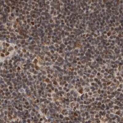 Immunohistochemistry-Paraffin: CCDC16 Antibody [NBP1-88165] - Staining of human lymph node.