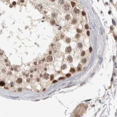 Immunohistochemistry-Paraffin: CCDC16 Antibody [NBP1-88165] - Staining of human testis.